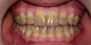 1836909-disinizin-rengi-hastaliginizi-ortaya-cikariyor-68a5c57050076