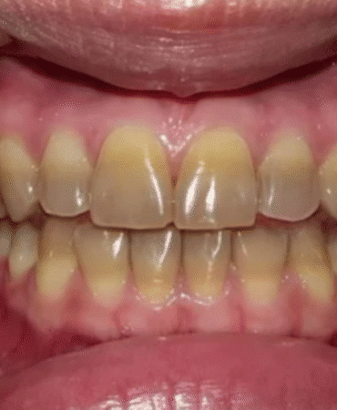 1836909-disinizin-rengi-hastaliginizi-ortaya-cikariyor-68a5c57050076