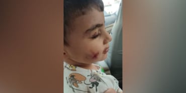 ankarada-korkunc-olay-uyuyan-cocugu-lagim-faresi-isirdi-fyvr