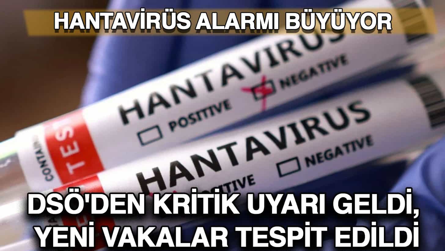 manset
